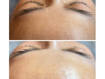 beauty salon Miiruの写真/【本気のシミ・くすみケア】ダウンタイムなしの美肌光フェイシャル★内側から発光するような極上のツヤ肌へ