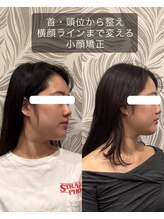ヴァリエス プライム 中目黒店(VARIES PRIME)/小顔矯正　勝山式美容矯正