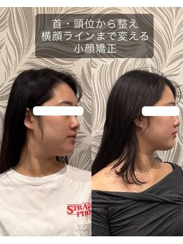 ヴァリエス プライム 中目黒店(VARIES PRIME)/小顔矯正　勝山式美容矯正
