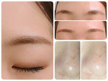 トータルビューティ ノイド(Noid)/小鼻コース＋美眉毛WAX脱毛