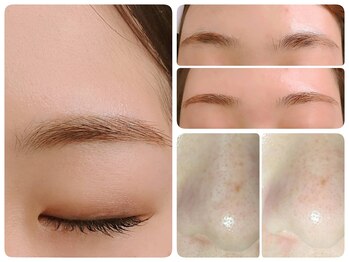 トータルビューティ ノイド(Noid)/小鼻コース+美眉毛WAX脱毛