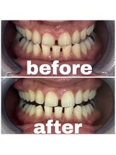 ルナ(LUNA)/20代男性初回お試し