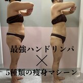 トータルエステサロン ヴィビ(Vi-Bi)