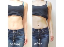 ルオント(LUONTO)/バストケアでクビレも出現