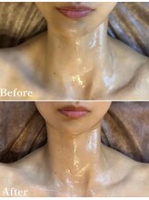 ファン 骨整体 アンド ビューティー ファン 鍼灸(Fan 骨整体&Beauty Fan 鍼灸)/筋膜リフト