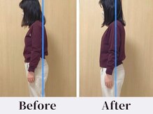 コンチ(KONCHI)/【姿勢改善】猫背・巻き肩解消！