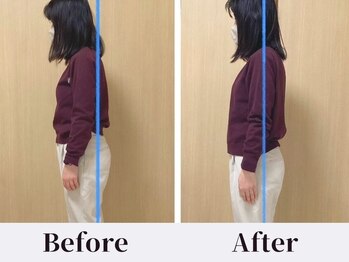 コンチ(KONCHI)/【姿勢改善】猫背・巻き肩解消！