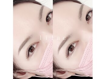 ライラック(lilac)/フラットラッシュstandardコース