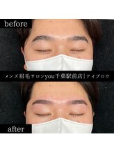 ユー 千葉駅前店(you)/ビフォ－アフター写真