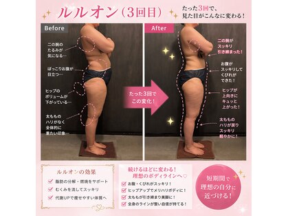 ヨサパーク 杣(YOSA PARK)の写真