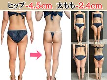 ヘッテ(Hette)