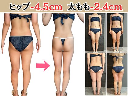 ヘッテ(Hette)の写真