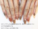 パーツも取れないトップジェル