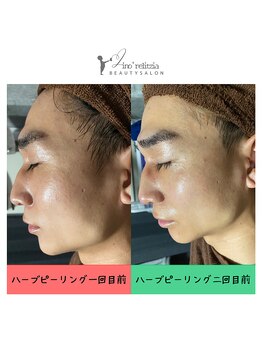 リノレリチア 心斎橋 新町店/メンズok