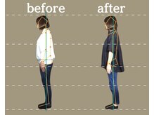 高座渋谷ポポの木整骨院/【ママに大人気の産後ケア】