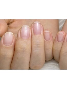 爪の悩みを解消できる（ケア含む）