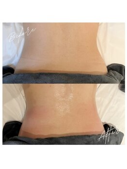 グレアージュ(GLEAGE)/くびれをつくる上半身集中痩身!