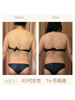 アクア(AQUA)/ハイパーナイフ痩身☆