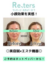 リターズ鍼灸治療所 天王寺院/Before-After