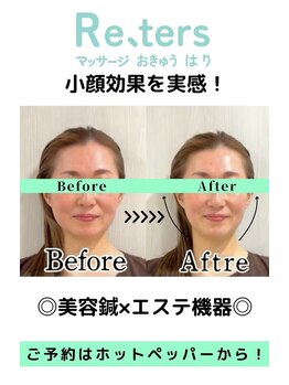 リターズ鍼灸治療所 天王寺院/Before-After