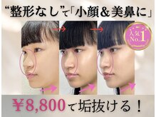 ラプリ 新宿店(Raplit)/隆鼻＋輪郭矯正40分30回
