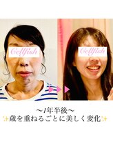 セルフィッシュ(Cellfish)/小顔矯正×DXフェイシャル