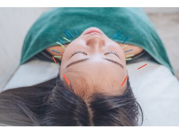 フォーユー 海南院(foryou)の写真/プロが鍼選びから拘る本格美容鍼◆ほうれい線・小顔・しみ・しわ・くすみ・フェイスラインなどにアプローチ