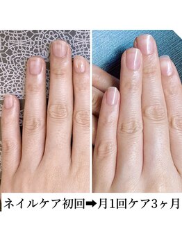 桃の木 吉祥寺店/#自爪育成　3