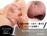 【毛穴吸引フェイシャル体験¥5800】小鼻のポツポツ黒ずみにはこれ！
