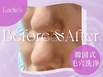 クリアラボ 錦糸町(Clear Lab)/韓国肌管理&毛穴洗浄専門店