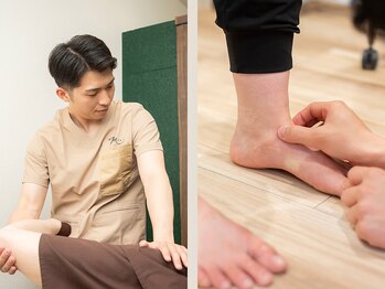 タクマ鍼灸整体院 高松(TaKuMa鍼灸整体院)の写真/1周年記念クーポン有【海外のハイレベルな技法を】足の違和感など気にせず走る/歩く事ができるようサポート