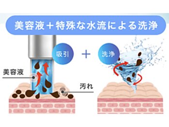 リンネ(Rin'ne)/トルネード水流での毛穴洗浄