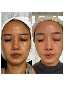 アンジュ/角質を整え栄養与える