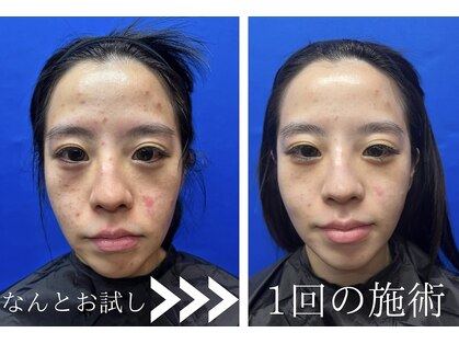 グリッター(GLITTER)の写真