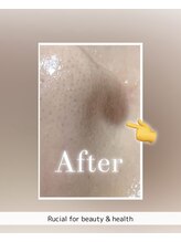 ルシアル(Rucial)/ワックス脱毛でちゅるちゅる！