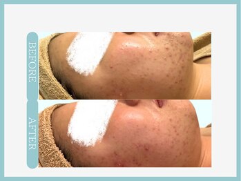 スリムライン 弘前店(The Slim Line)/before→after