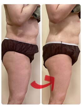 エステティックサロン ココチ(Cocochi)/新メニュー!かっさでスッキリ♪