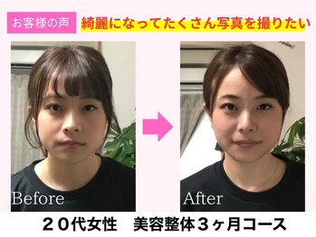 よしみち整体院/小顔矯正でリフトアップ♪