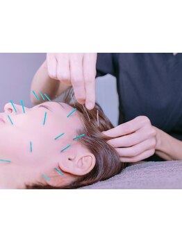 小顔になりたい