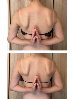 チェリッシュ(cherish)/肩甲骨剥がしで背中美人dに!