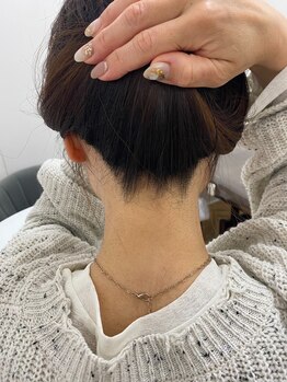 ミース 宮崎店/うなじ脱毛で後ろ姿美人になれる