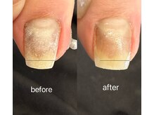 プシュウ(PUSHW)の雰囲気（甘皮ケア、巻き爪サポート、ジェルコーティング（２０分）初回）