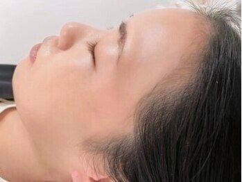 フィズアイビューティー 岡崎竜美ヶ丘店(fiz eye beauty)の写真/【美肌×垢抜け】ツヤっと輝く透明感！余分な産毛、角質オフでメイクのり劇的アップ。全顔フェイスワックス