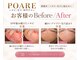ポアレ(POARE)の写真