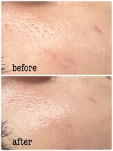 シエル ブルー(Ciel Blue)/Before→After