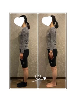 プルーム 大橋店(plume)/20代女性/首・肩こり、猫背