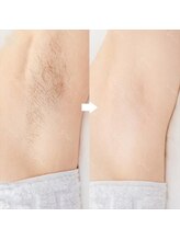 エルアンドエル(L&L)/