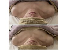 ルルボーテ(Loulou Beaute)/トリムハンド