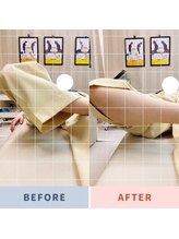 ナオル整体 三鷹院(NAORU整体)/20代女性施術事例【股関節開脚】