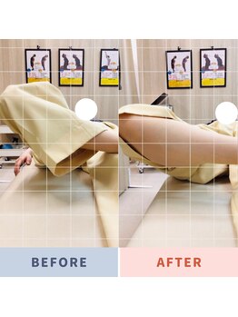 ナオル整体 三鷹院(NAORU整体)/20代女性施術事例【股関節開脚】